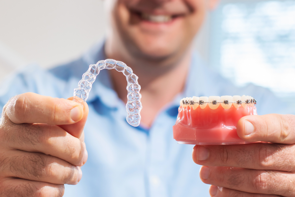 Braces; clear aligners